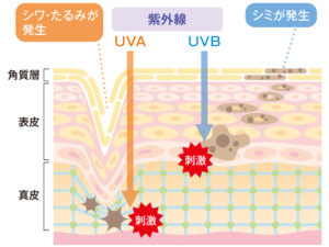 紫外線によるダメージ