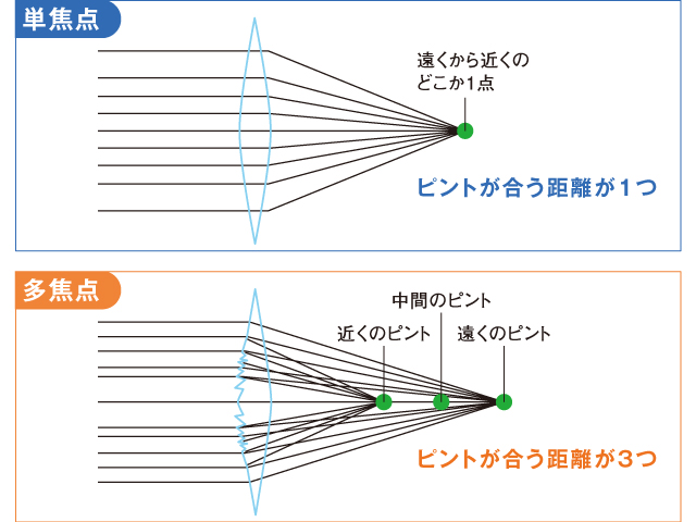 単焦点眼内レンズと多焦点眼内レンズ