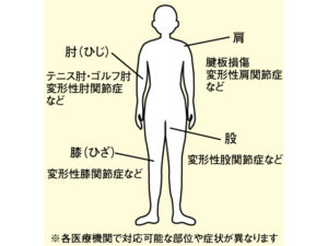 PRP療法が適応する症状例